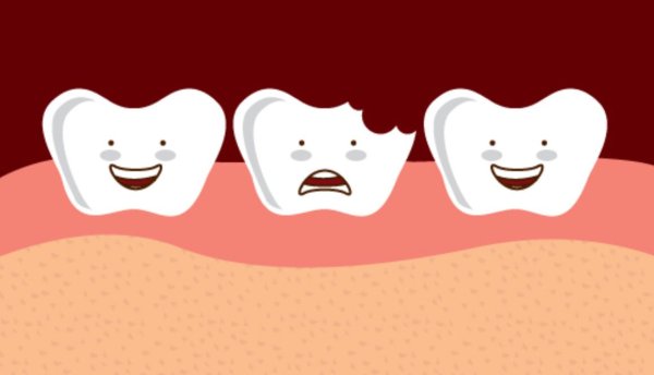 Международный день борьбы с кариесом зубов 4 июня