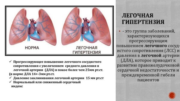 Всемирный день легочной гипертензии 5 мая