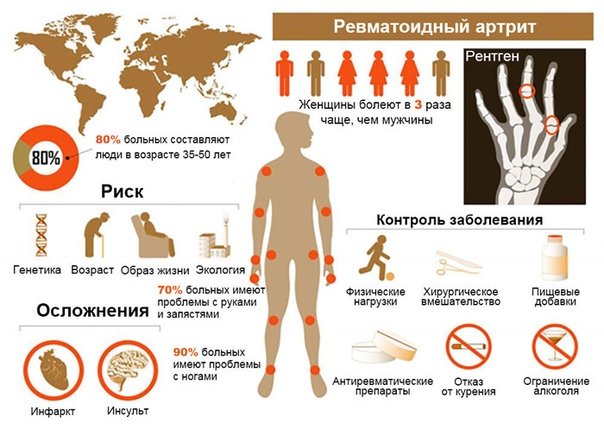 День осведомлённости о ревматоидном артрите 2 февраля